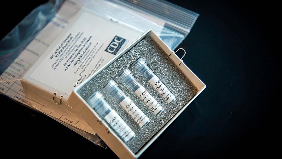 First COVID-19 vaccine trial starts Monday in Seattle, government official says